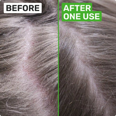 SCALP HEALTH Shampoo Bar